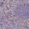 Kazrin, Periplakin Interacting Protein antibody, NBP2-48622, Novus Biologicals, Immunohistochemistry frozen image 