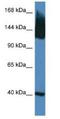 Solute Carrier Family 12 Member 5 antibody, NBP1-74063, Novus Biologicals, Western Blot image 