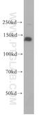 Proteasome Activator Subunit 4 antibody, 18799-1-AP, Proteintech Group, Western Blot image 