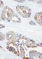 Receptor Tyrosine Kinase Like Orphan Receptor 1 antibody, PA1862, Boster Biological Technology, Immunohistochemistry frozen image 