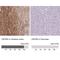 Chemokine-like factor superfamily member 5 antibody, NBP2-47503, Novus Biologicals, Immunohistochemistry paraffin image 