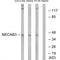 N-Terminal EF-Hand Calcium Binding Protein 3 antibody, A11525, Boster Biological Technology, Western Blot image 