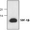 C-X-C Motif Chemokine Ligand 12 antibody, GTX59870, GeneTex, Western Blot image 