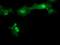 Metabolism Of Cobalamin Associated C antibody, MA5-26017, Invitrogen Antibodies, Immunocytochemistry image 