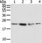 RAB2A, Member RAS Oncogene Family antibody, TA351899, Origene, Western Blot image 