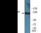 Janus Kinase 3 antibody, EKC2304, Boster Biological Technology, Western Blot image 