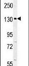 Capicua Transcriptional Repressor antibody, PA5-24198, Invitrogen Antibodies, Western Blot image 