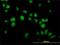 Ubiquitin Specific Peptidase 14 antibody, H00009097-M04, Novus Biologicals, Immunofluorescence image 
