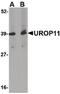 Amyloid Beta Precursor Protein Binding Family A Member 1 antibody, PA5-20525, Invitrogen Antibodies, Western Blot image 