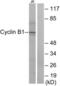 Cyclin B1 antibody, LS-C198856, Lifespan Biosciences, Western Blot image 