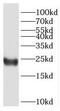 High Mobility Group Box 4 antibody, FNab03927, FineTest, Western Blot image 