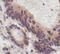 Ribosomal Protein S6 Kinase B1 antibody, MA5-15141, Invitrogen Antibodies, Immunohistochemistry paraffin image 