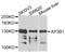 Adaptor Related Protein Complex 3 Subunit Beta 1 antibody, A7019, ABclonal Technology, Western Blot image 
