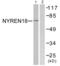 Negative Regulator Of Ubiquitin Like Proteins 1 antibody, abx013222, Abbexa, Western Blot image 