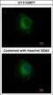 Plasminogen antibody, GTX102877, GeneTex, Immunocytochemistry image 