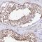 Abhydrolase Domain Containing 5 antibody, HPA035851, Atlas Antibodies, Immunohistochemistry frozen image 