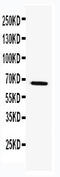 TNF Receptor Associated Factor 5 antibody, LS-C313261, Lifespan Biosciences, Western Blot image 