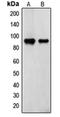 Transglutaminase 2 antibody, orb214666, Biorbyt, Western Blot image 