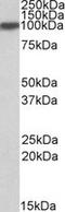 Aconitase 1 antibody, TA305638, Origene, Western Blot image 