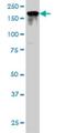 Ras GTPase-activating-like protein IQGAP2 antibody, H00010788-M01, Novus Biologicals, Western Blot image 