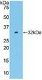 Oncostatin M Receptor antibody, MBS2006458, MyBioSource, Western Blot image 