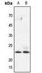 Hematopoietic prostaglandin D synthase antibody, MBS820826, MyBioSource, Western Blot image 