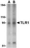 Toll Like Receptor 1 antibody, TA306266, Origene, Western Blot image 