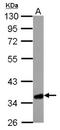3-Hydroxy-3-Methylglutaryl-CoA Lyase antibody, NBP1-32767, Novus Biologicals, Western Blot image 