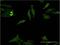 Distal-Less Homeobox 5 antibody, H00001749-M12, Novus Biologicals, Immunocytochemistry image 
