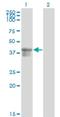 Serpin Family B Member 3 antibody, H00006317-M01, Novus Biologicals, Western Blot image 