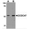 Coiled-Coil Domain Containing 47 antibody, MBS150663, MyBioSource, Western Blot image 