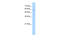 Solute Carrier Family 22 Member 16 antibody, 29-946, ProSci, Western Blot image 