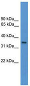 Olfactory Receptor Family 1 Subfamily J Member 1 antibody, TA342699, Origene, Western Blot image 