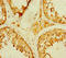 Transcriptional Adaptor 2B antibody, orb33491, Biorbyt, Immunohistochemistry paraffin image 