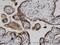 ADP-Ribosylarginine Hydrolase antibody, H00000141-M04, Novus Biologicals, Immunohistochemistry paraffin image 