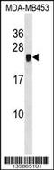 Cysteine Rich Protein 2 antibody, 58-524, ProSci, Western Blot image 