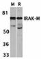 Interleukin 1 Receptor Associated Kinase 3 antibody, orb74434, Biorbyt, Western Blot image 