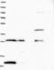 Radical S-Adenosyl Methionine Domain Containing 1 antibody, NBP1-83771, Novus Biologicals, Western Blot image 