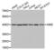 Interferon-inducible protein AIM2 antibody, abx002396, Abbexa, Western Blot image 