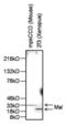 Mal, T Cell Differentiation Protein antibody, GTX15418, GeneTex, Western Blot image 