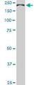 CDC42 Binding Protein Kinase Beta antibody, H00009578-M03, Novus Biologicals, Western Blot image 