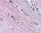 Adenosine Monophosphate Deaminase 1 antibody, PA5-23172, Invitrogen Antibodies, Immunohistochemistry paraffin image 