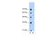 Sep (O-Phosphoserine) TRNA:Sec (Selenocysteine) TRNA Synthase antibody, 29-515, ProSci, Enzyme Linked Immunosorbent Assay image 