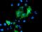 Protein Tyrosine Phosphatase Non-Receptor Type 7 antibody, MA5-25701, Invitrogen Antibodies, Immunocytochemistry image 