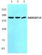 Rho Guanine Nucleotide Exchange Factor 10 antibody, PA5-36923, Invitrogen Antibodies, Western Blot image 