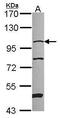 N-alpha-acetyltransferase 15, NatA auxiliary subunit antibody, PA5-30424, Invitrogen Antibodies, Western Blot image 