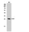 DNA Damage Inducible Transcript 3 antibody, STJ92277, St John