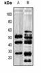 IQ Motif Containing GTPase Activating Protein 3 antibody, orb78042, Biorbyt, Western Blot image 
