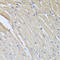 Corticotropin Releasing Hormone Binding Protein antibody, LS-B15599, Lifespan Biosciences, Immunohistochemistry frozen image 