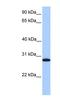 Cyclin Dependent Kinase Inhibitor 3 antibody, NBP1-58079, Novus Biologicals, Western Blot image 